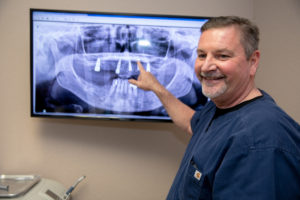 Dr Brand showing x-ray of dental implants Ocala , FL
