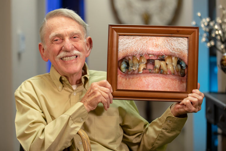 William's implant supported dentures Ocala, FL