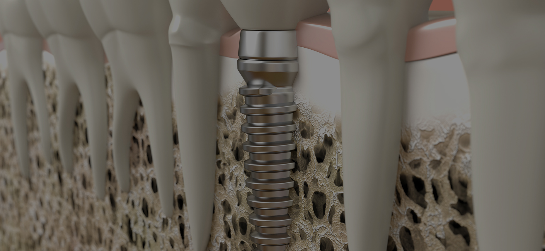 accordion-bg-img