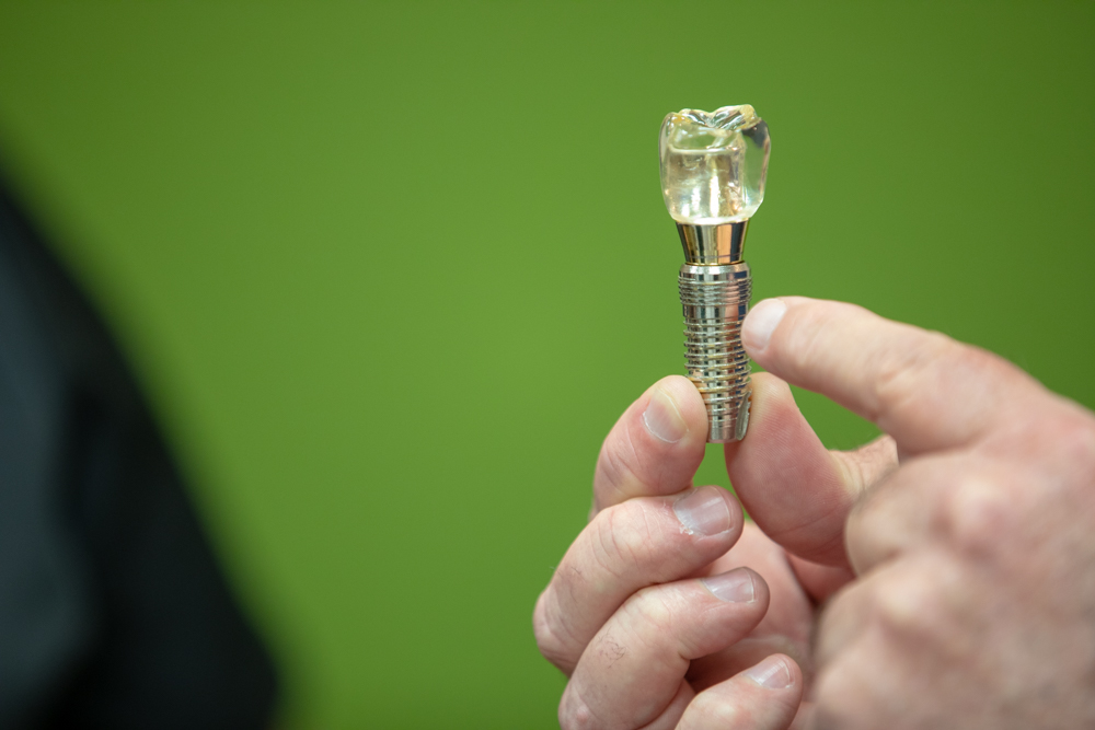 Dental Implant Model
