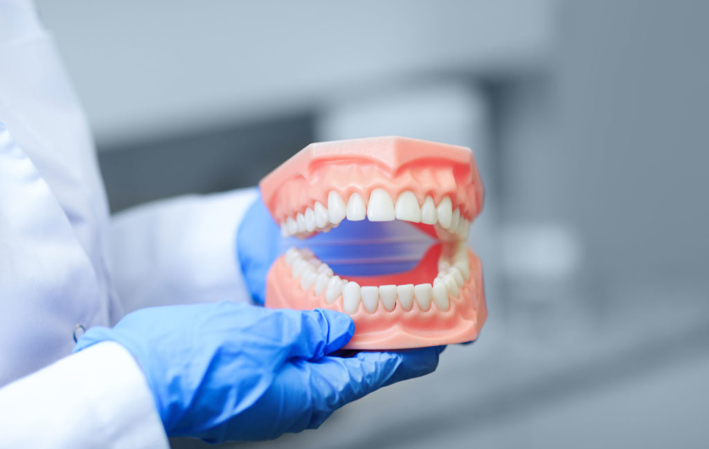 Dentures Model