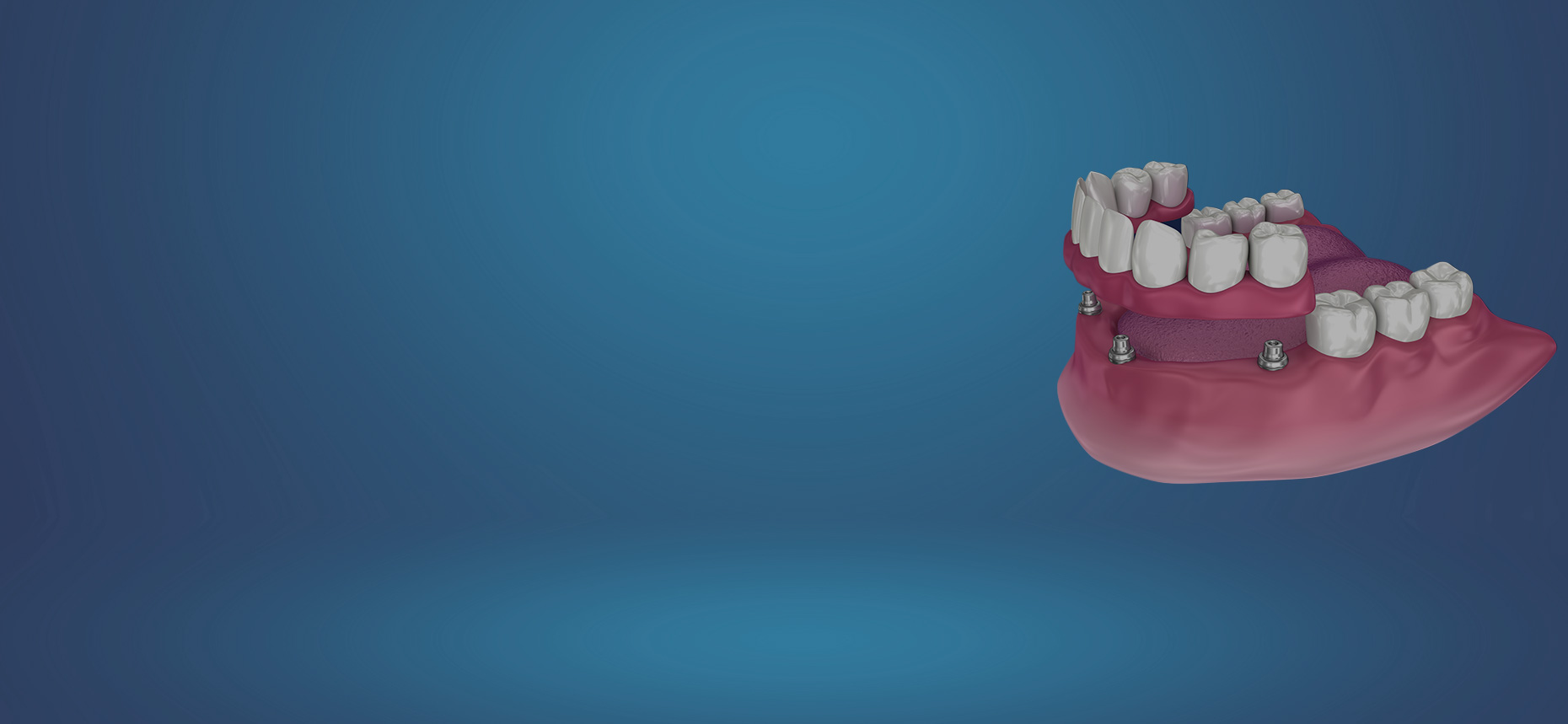 accordion-bg-img