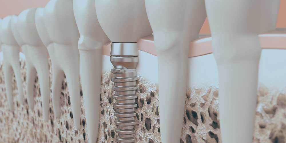 digital graphic of bone morphogenetic protein or bmp