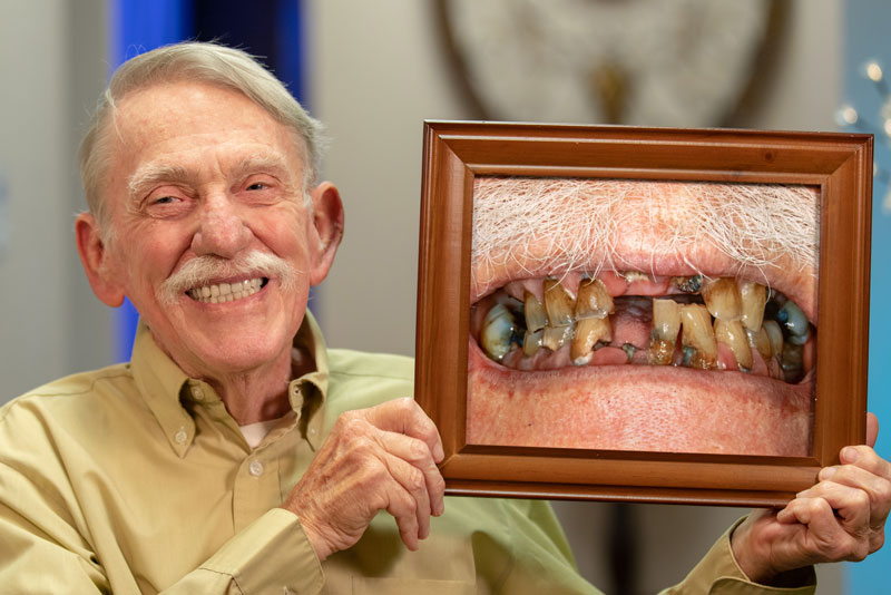 Full Arch Dental Implant Patient Holding Up A Before And After Photo