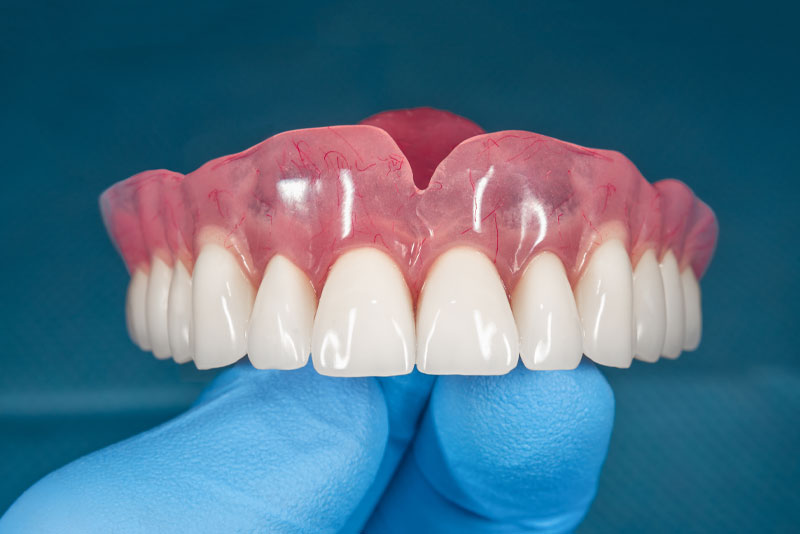 Full Denture Model