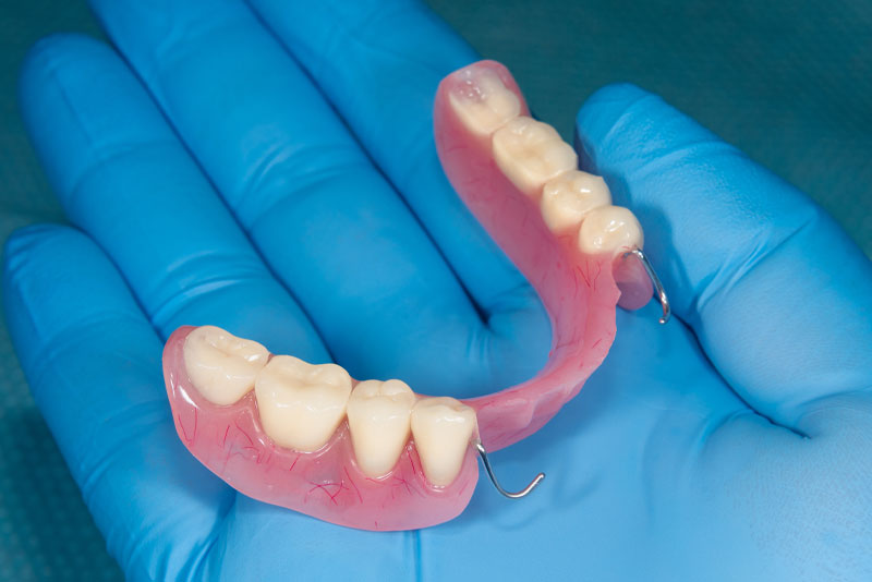 a dentist holding a loosened denture