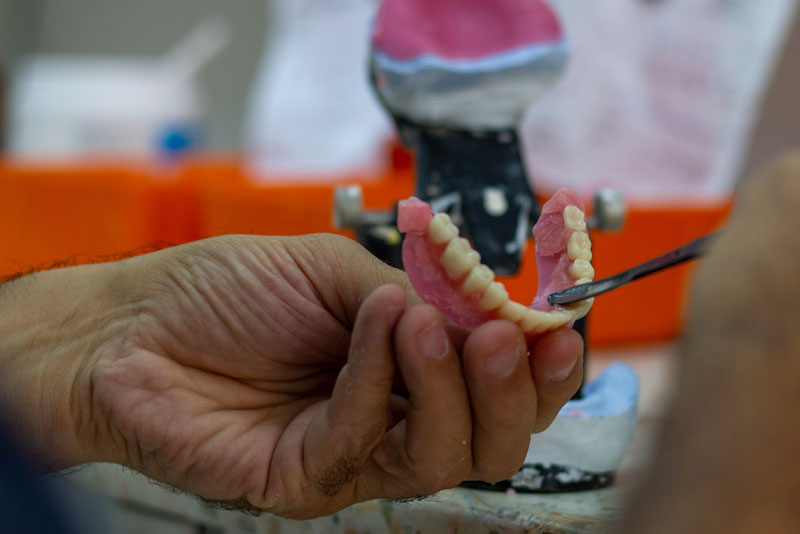 a dental professional working on a full arch dental implant prosthesis.