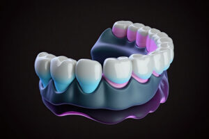 a digital model of a full row of dental implant replacement teeth.