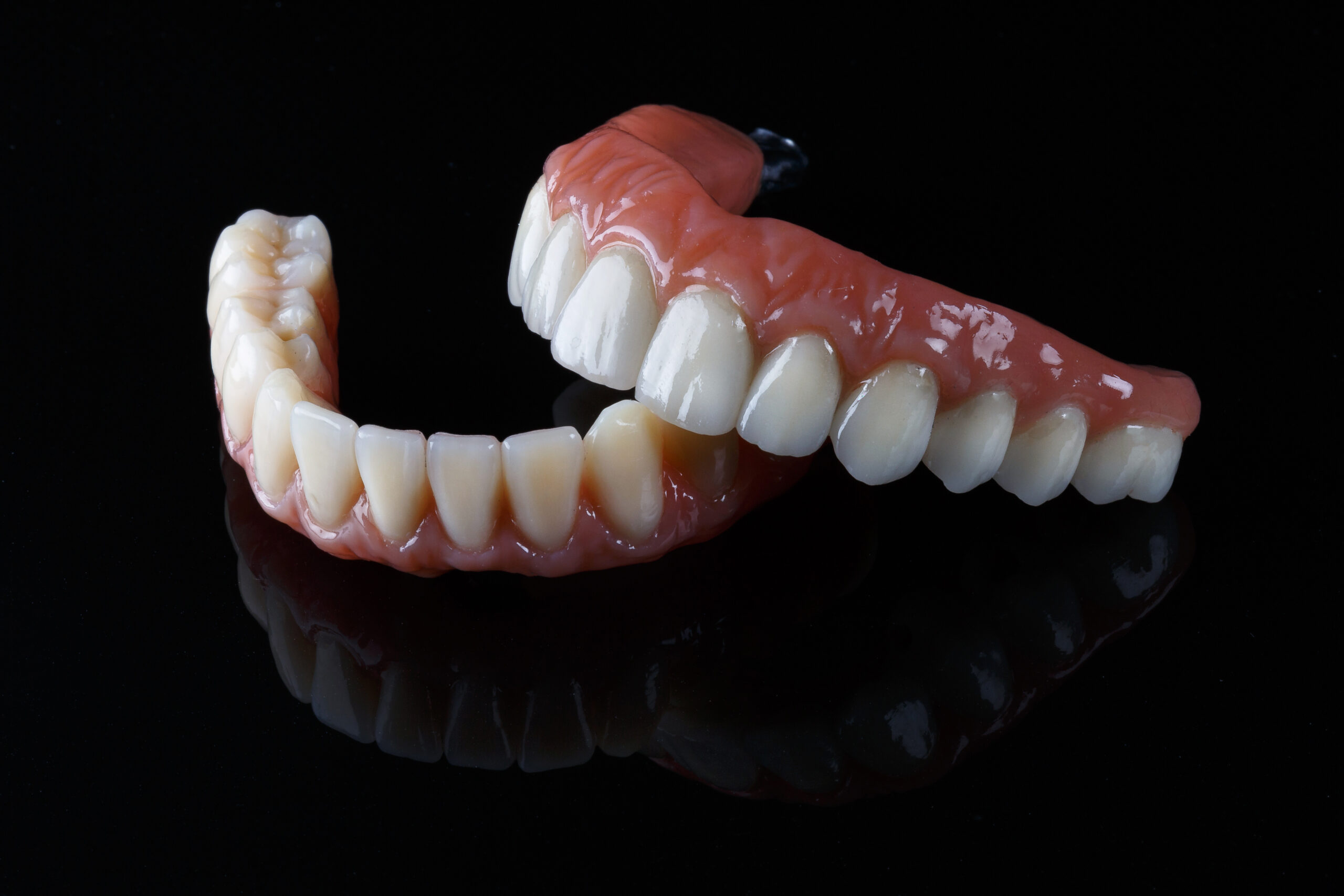 an All-On-4 dental implant model that shows All-On-4 dental implant candidates how their new smile will be restored.