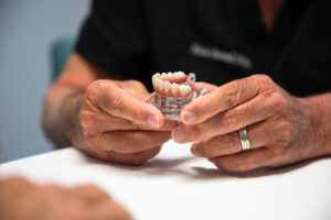 all-on-4 full mouth dental implants with dr nick brand.