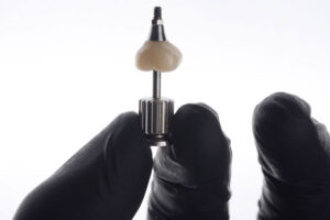 a single dental implant being held in with a crown on top of it