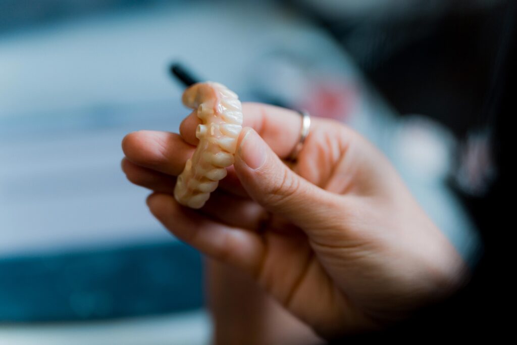 Dental Implants Model