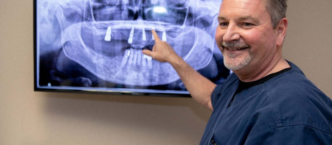 Dr Brand showing x-ray of dental implants Ocala , FL