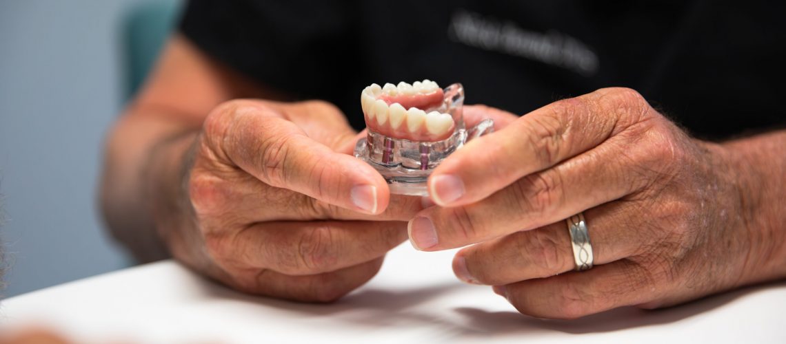 all-on-4 full mouth dental implants with dr nick brand.