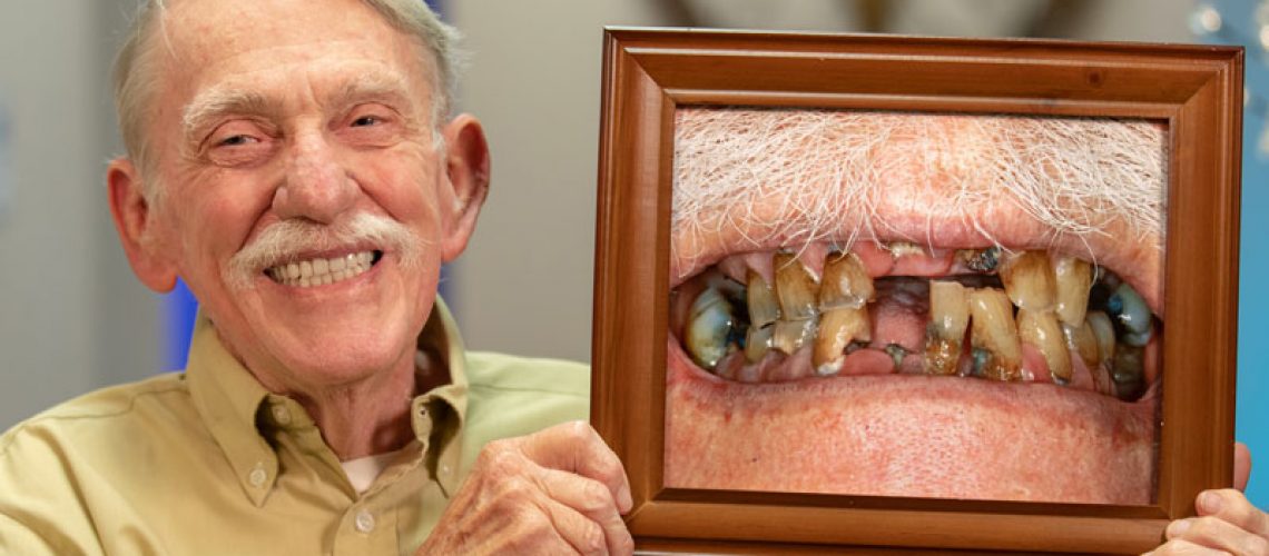 Full Arch Dental Implant Patient Holding Up A Before And After Photo