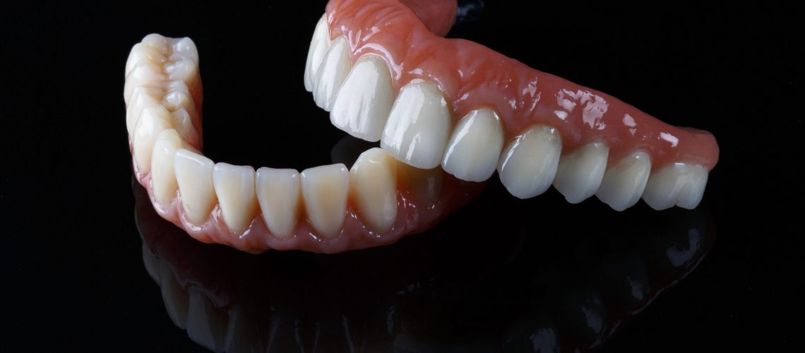 an All-On-4 dental implant model that shows All-On-4 dental implant candidates how their new smile will be restored.