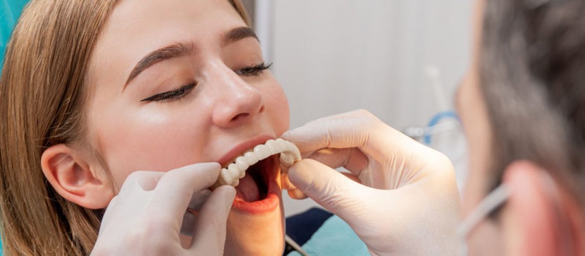a dental patient being fitted for full mouth dental implant restorations.