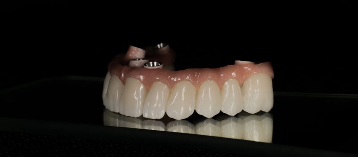 a full arch of zirconia teeth with holes for placement onto the mouth