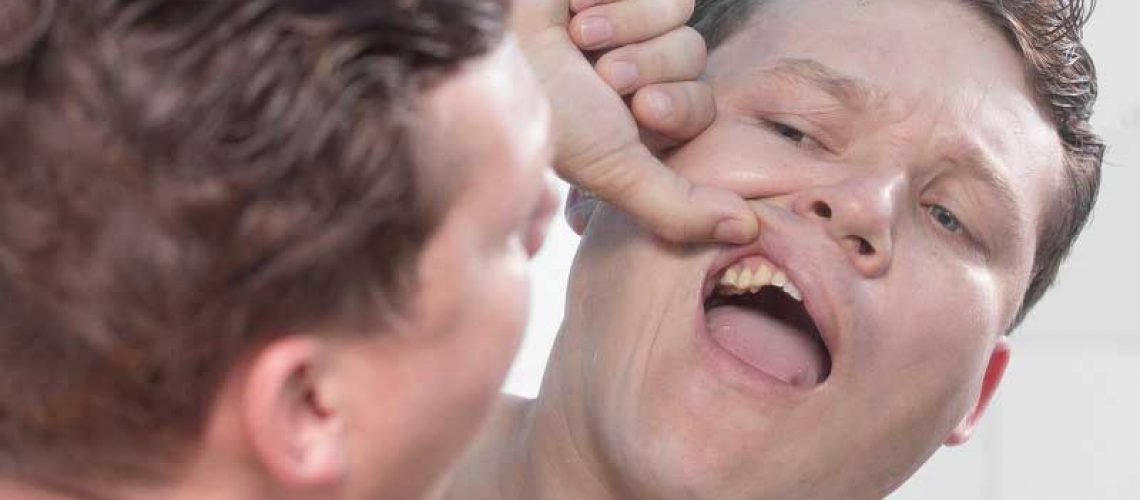 dental patient with a loose tooth