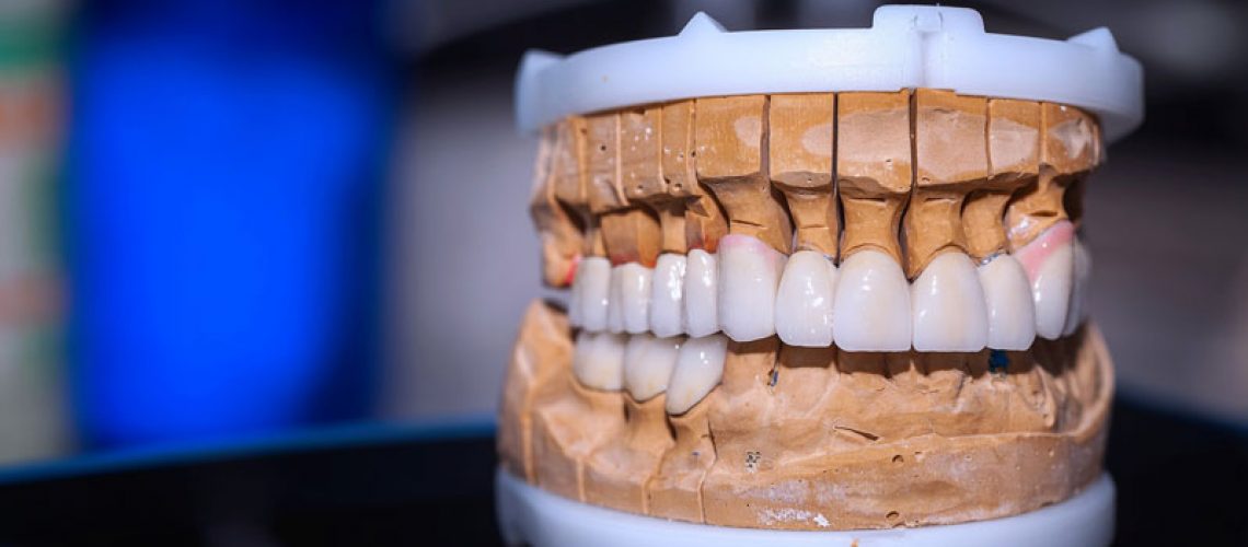 Close up photo of a professional mouth prosthesis model