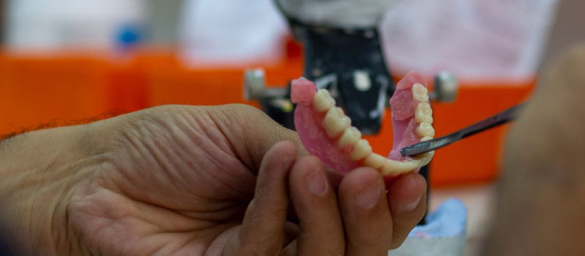 a dental professional working on a full arch dental implant prosthesis.