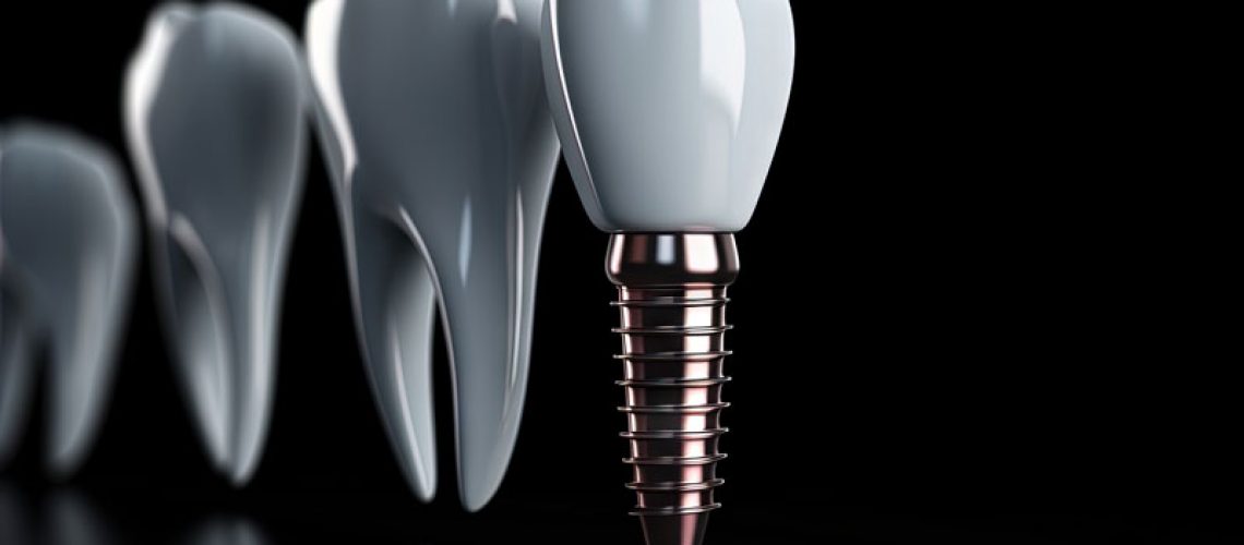 Digital model of a dental implant on a blacked out background